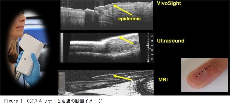 OCTスキャナーとイメージ